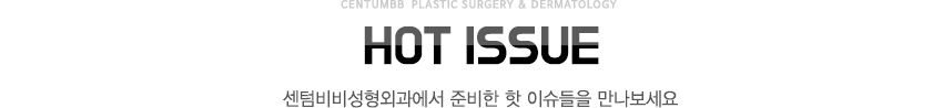 hot issue