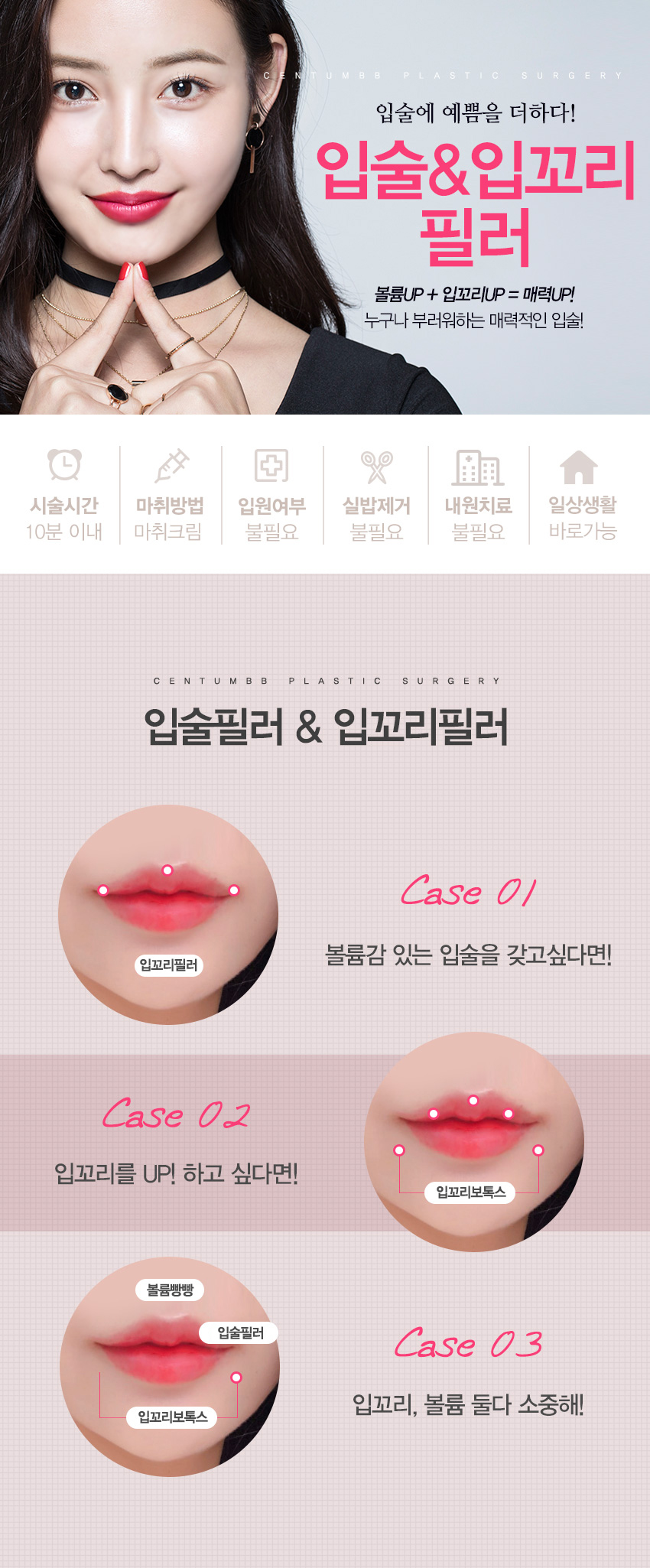 입꼬리필러