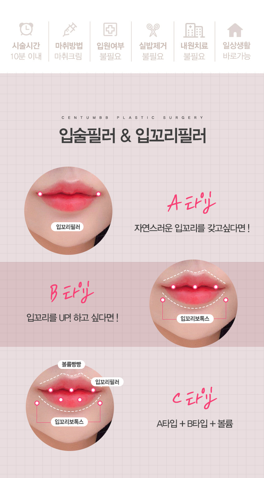 입꼬리필러