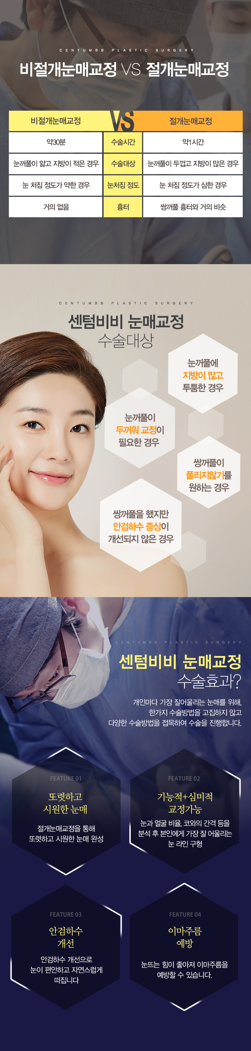 눈매교정