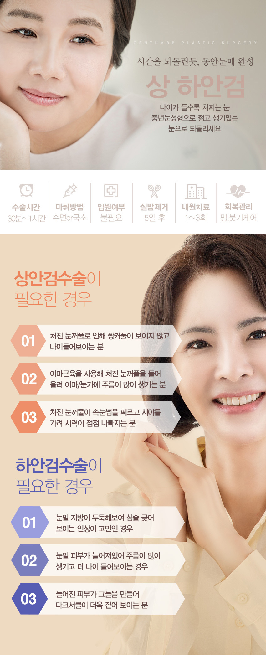 상/하안검