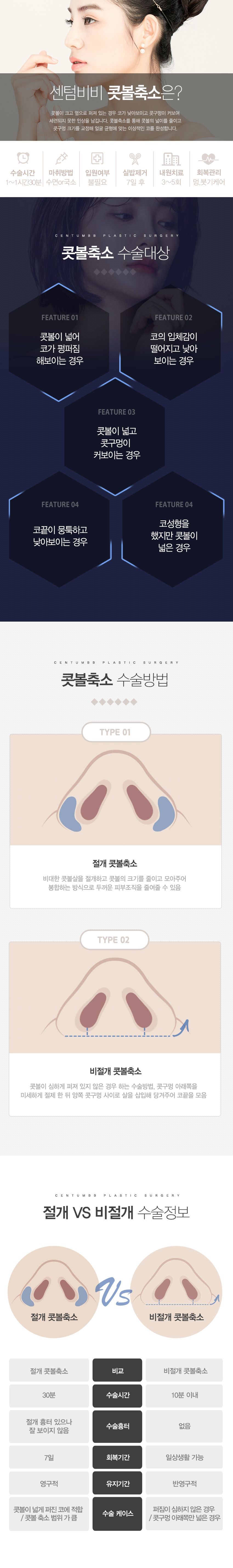 콧볼축소
