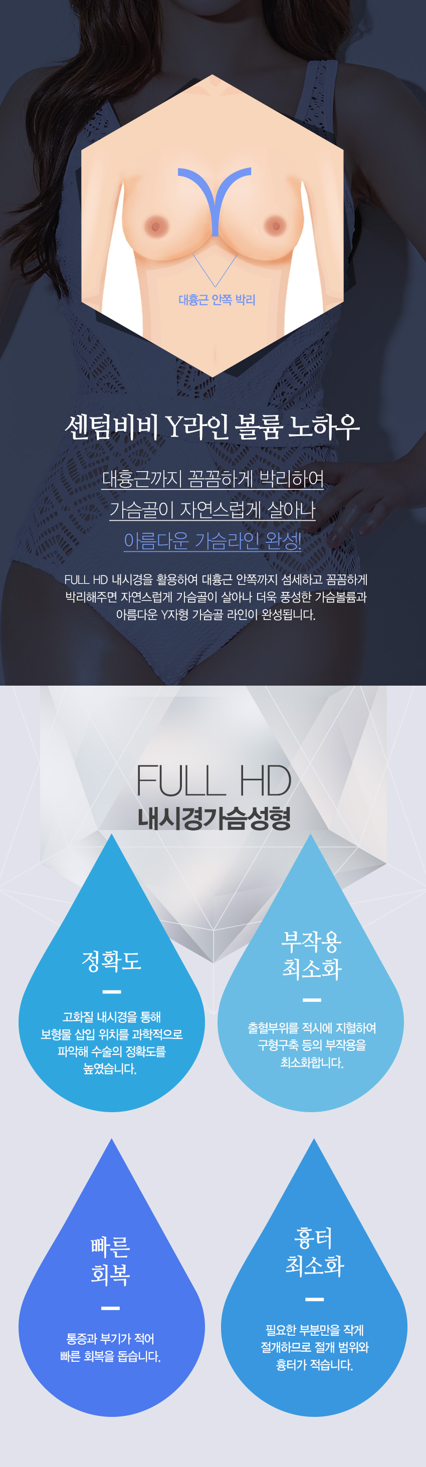 내시경가슴성형