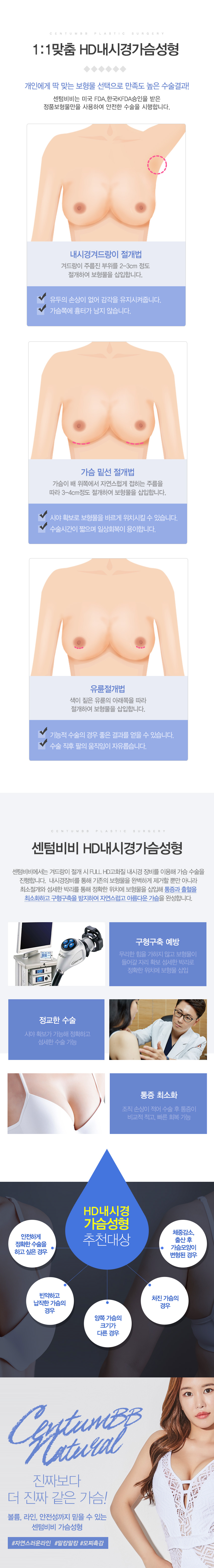 내시경가슴성형