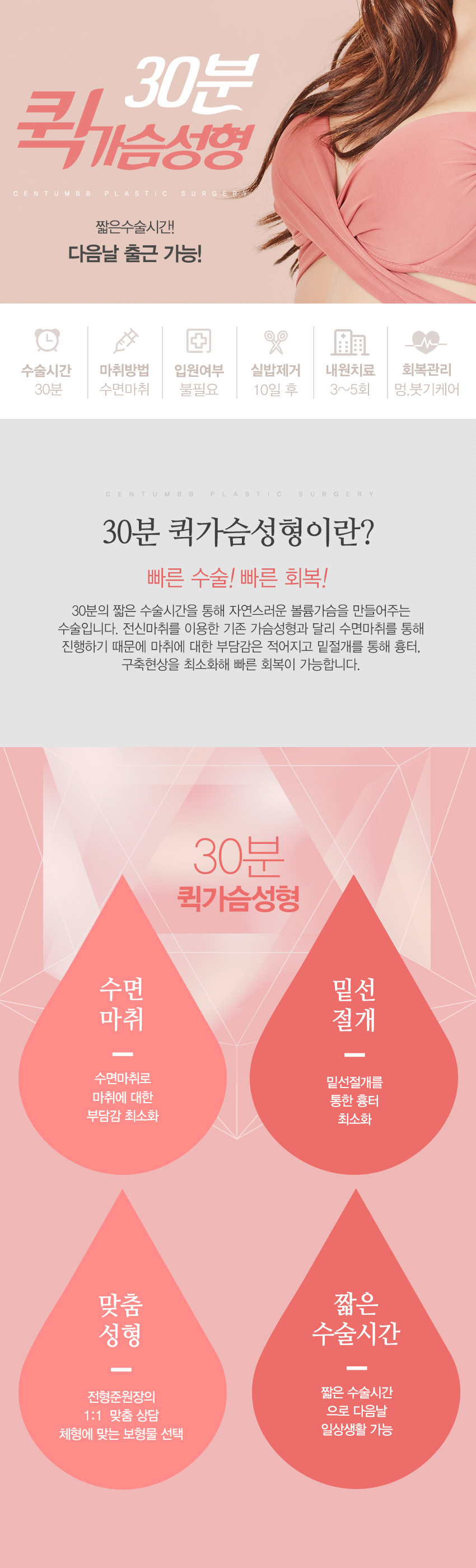 퀵가슴성형
