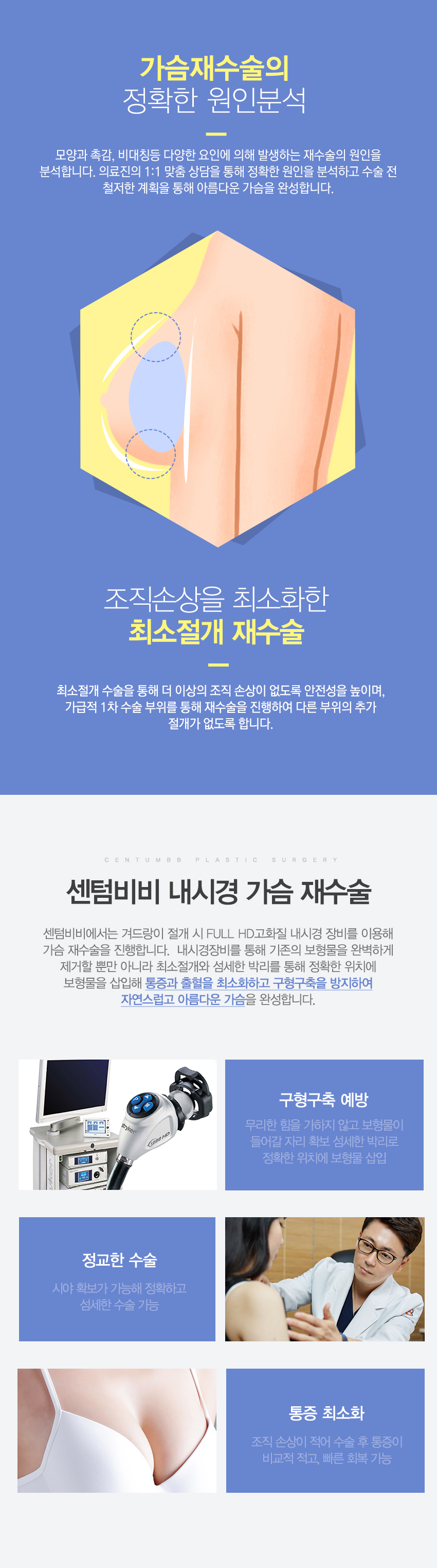 가슴재수술