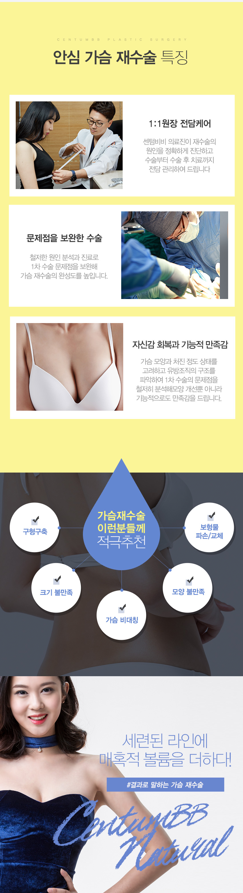 가슴재수술