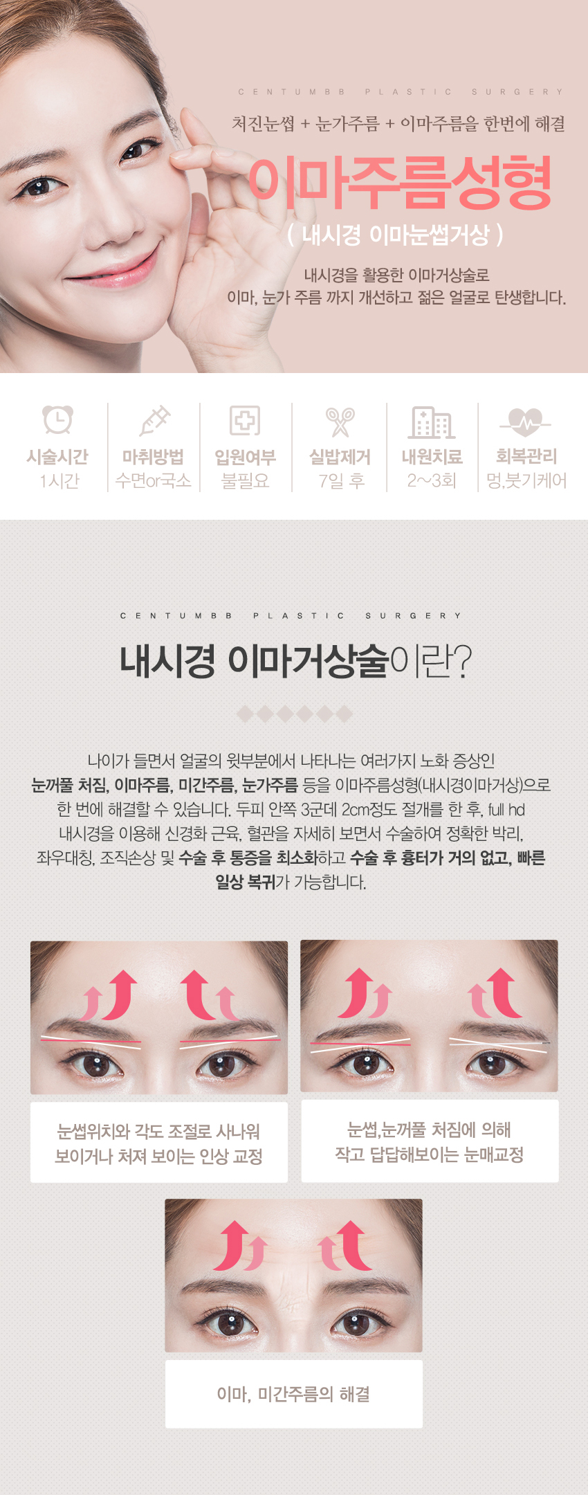 이마주름성형