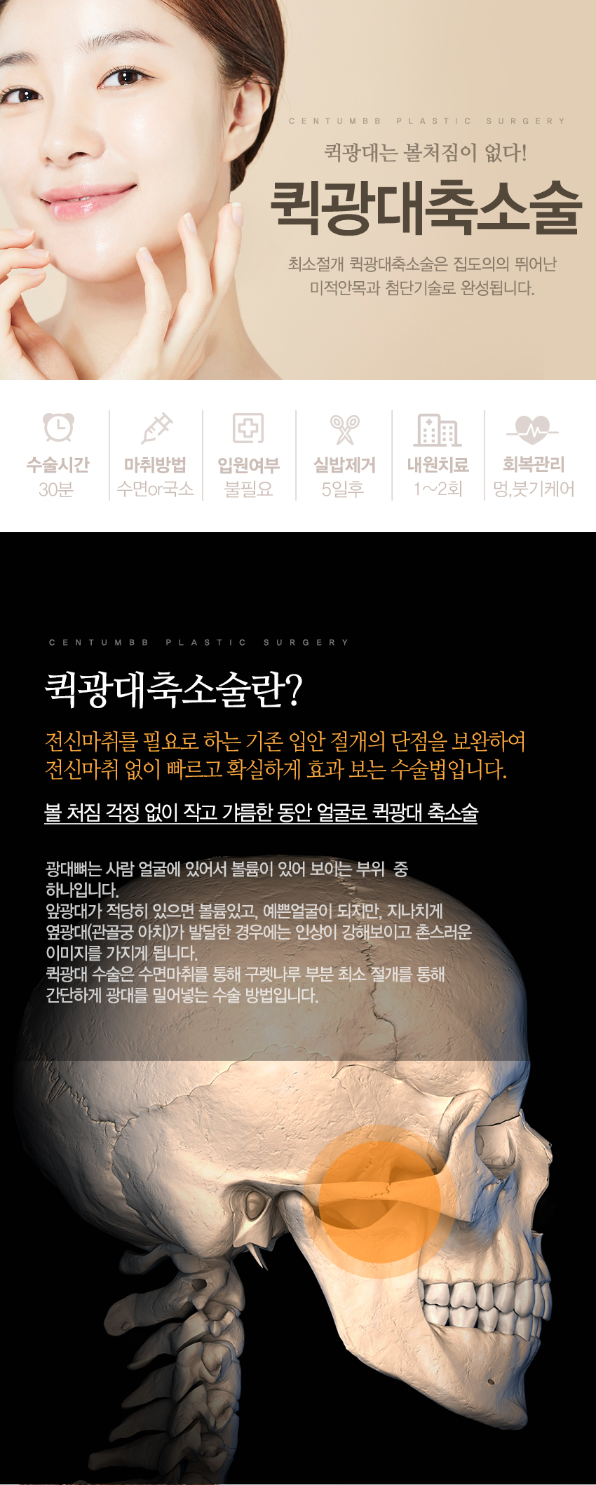 퀵 광대축소술