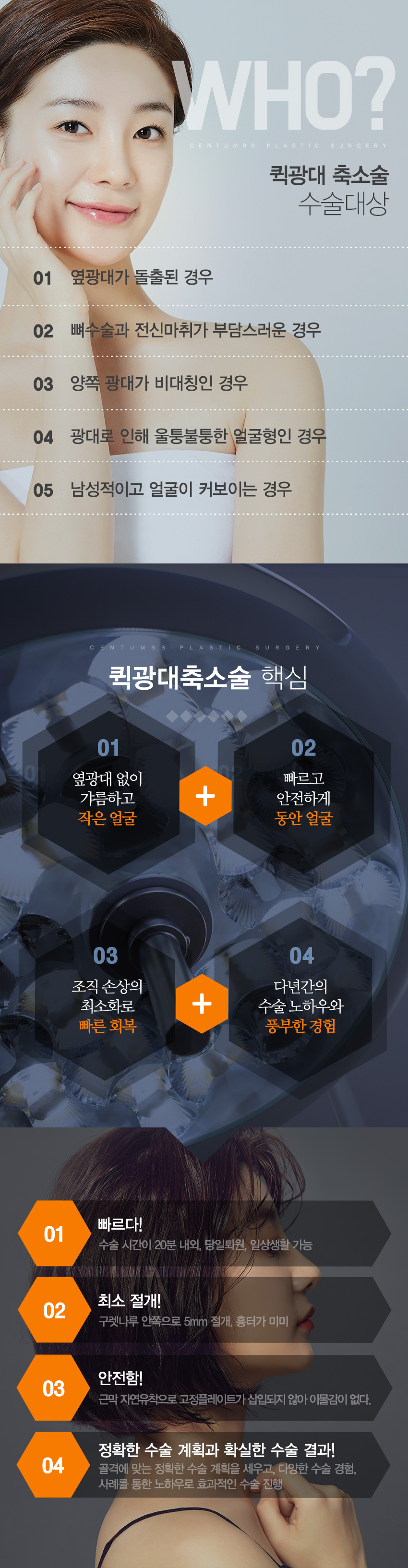 퀵 광대축소술