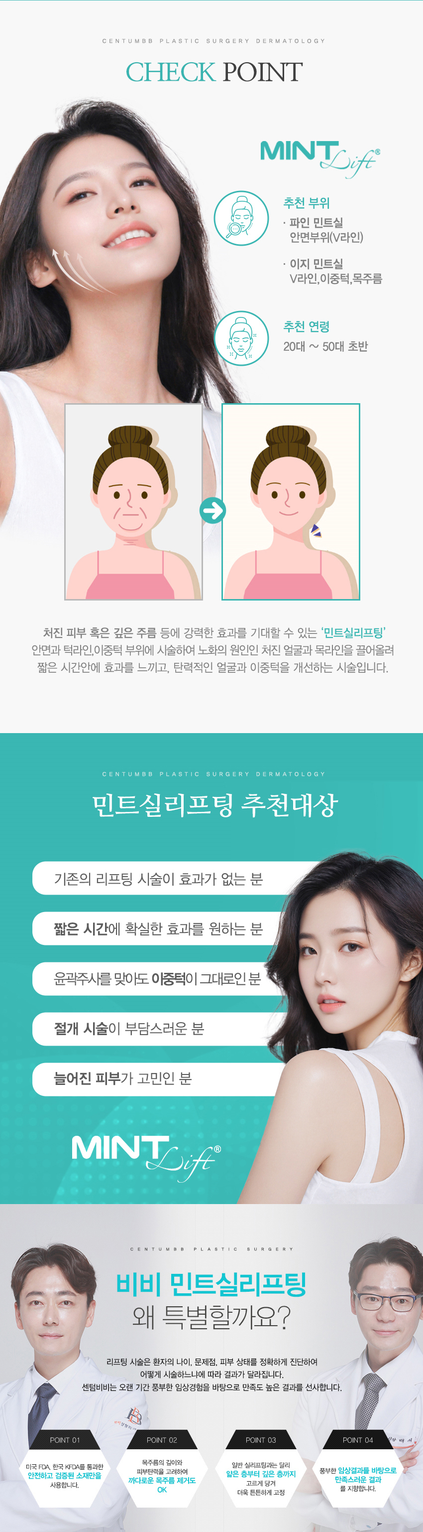 민트실리프팅