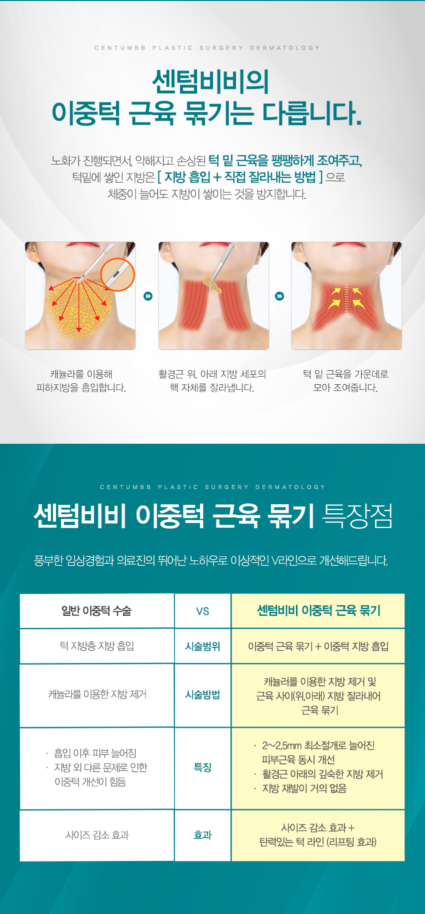 이중턱 근육 묶기