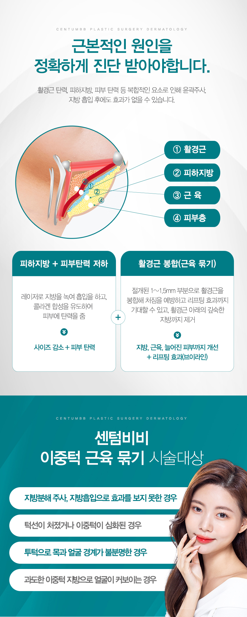 이중턱 근육 묶기