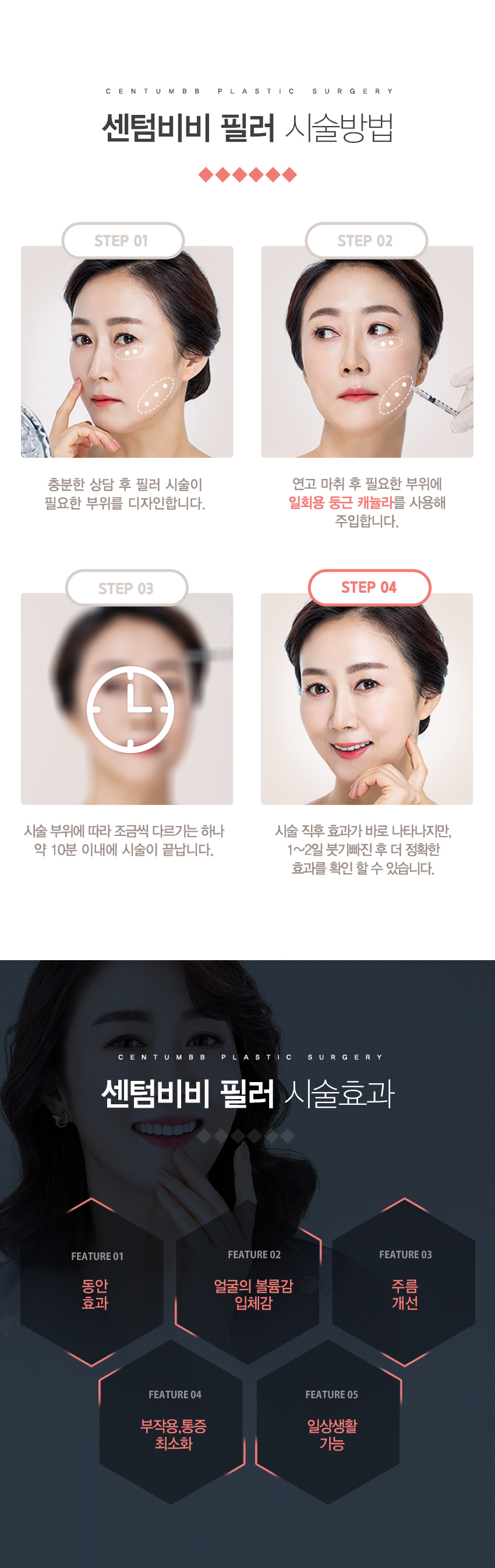 보톡스필러