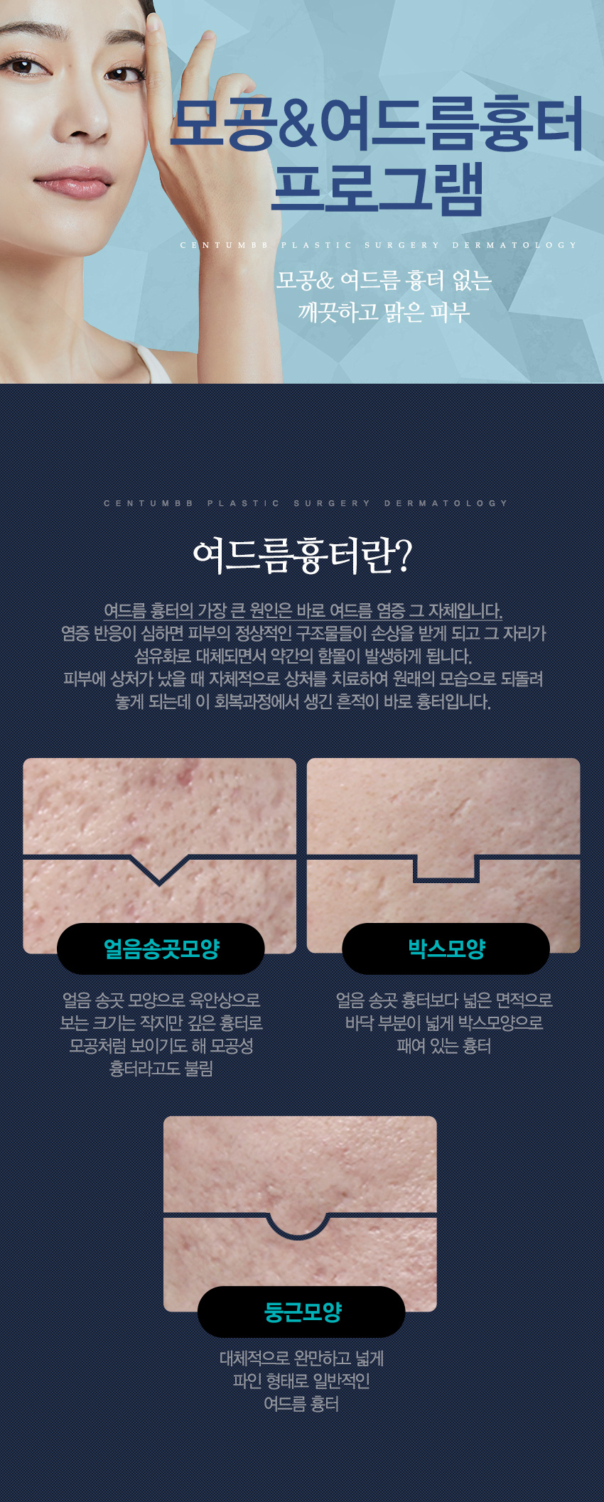 여드름흉터