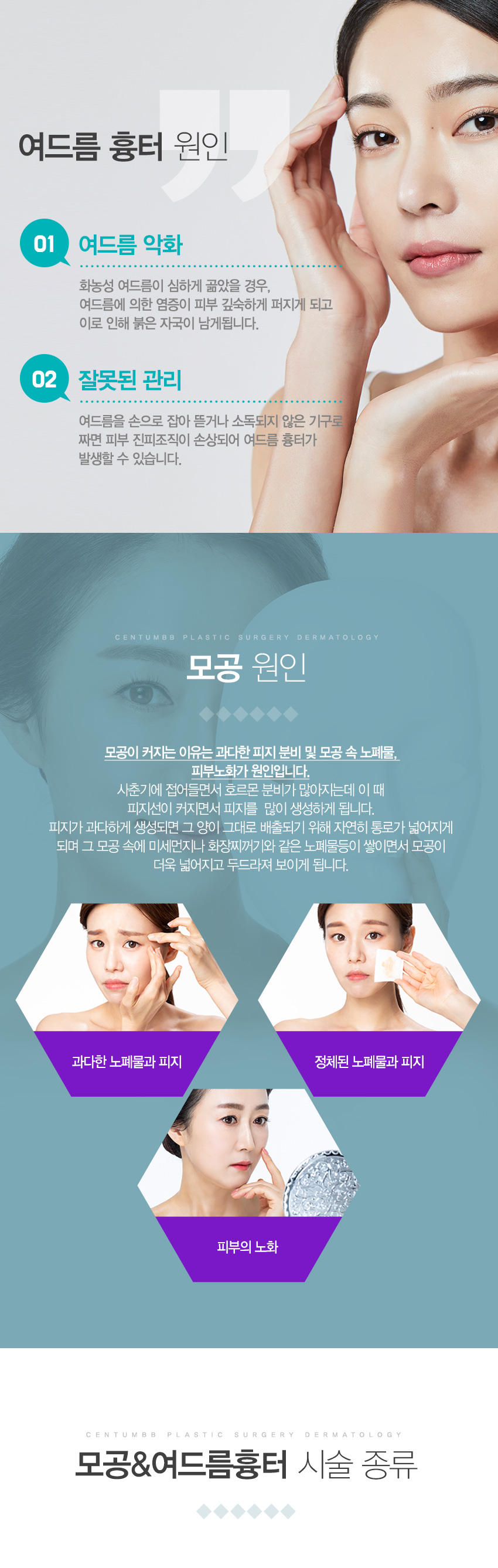 여드름흉터