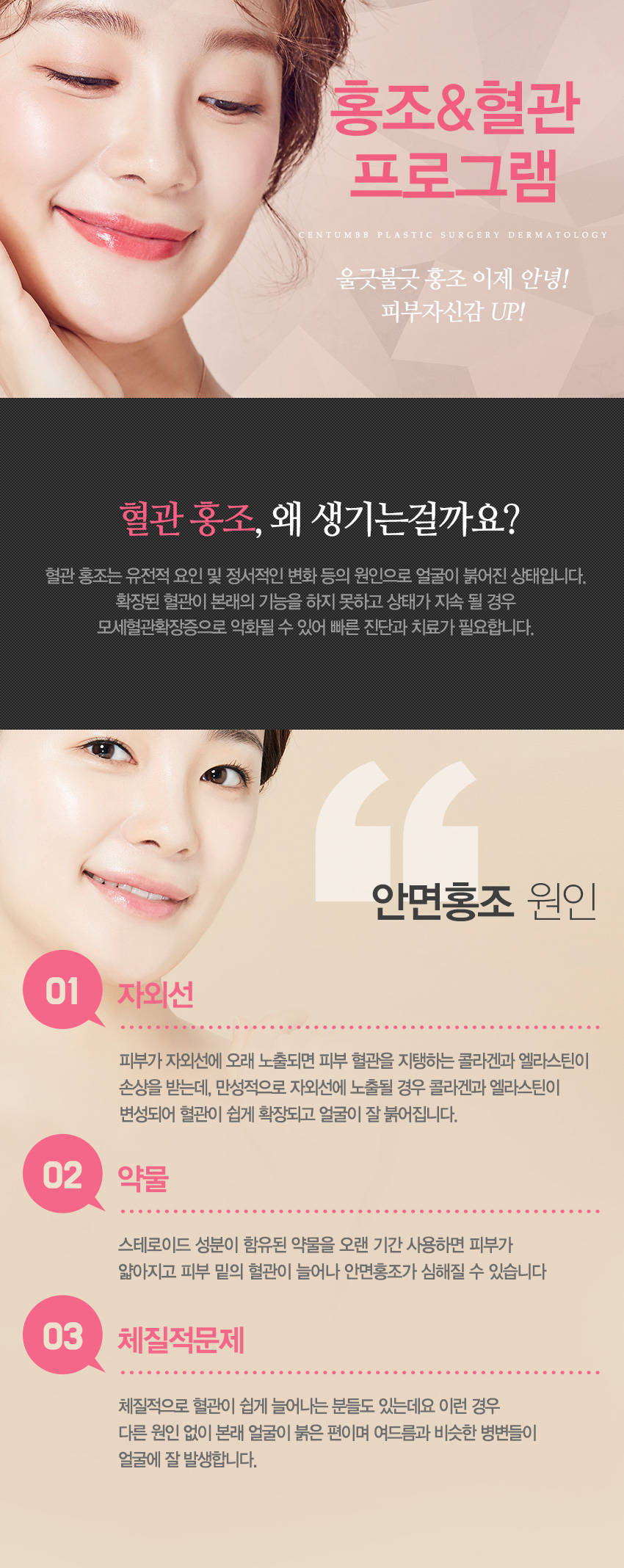 홍조혈관