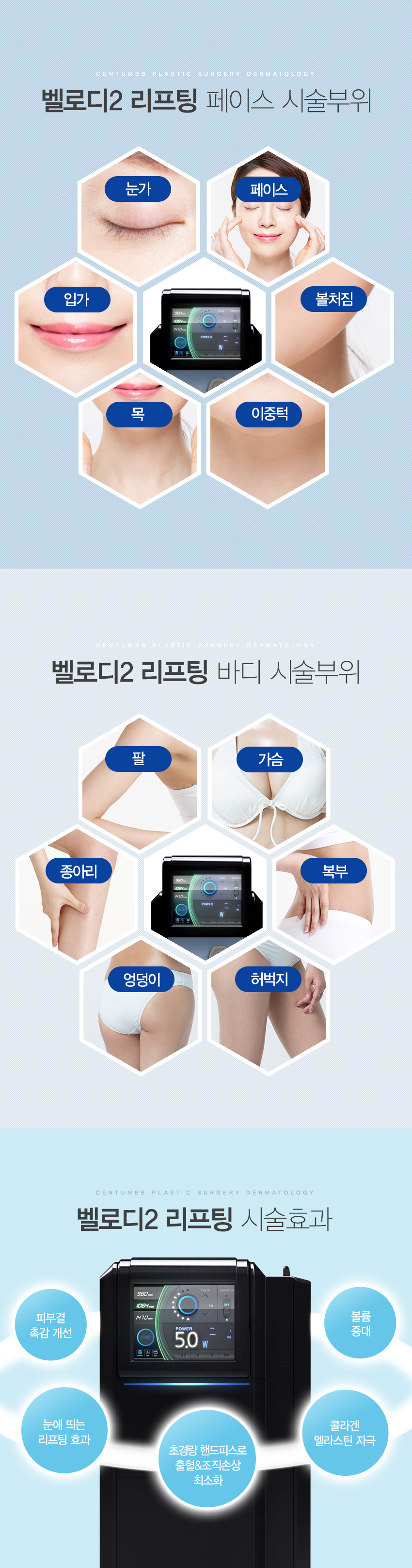 벨로디2리프팅