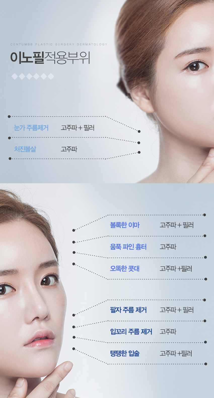 벨로디2리프팅