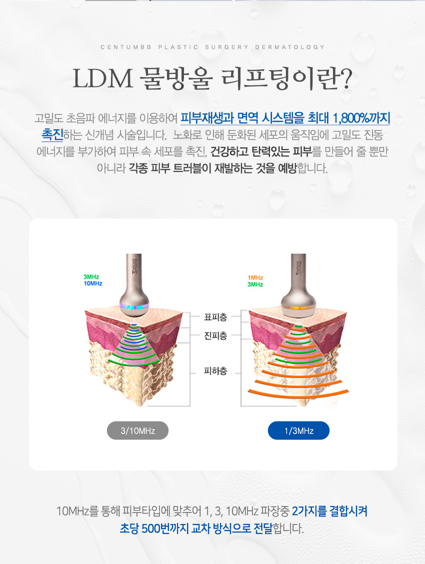 LDM 물방울리프팅